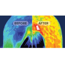 Derka Akupresurowa Original Accuhorsemat